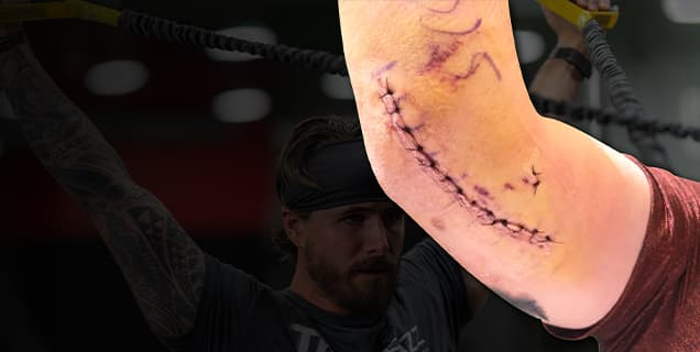 Arm Pain & Injury