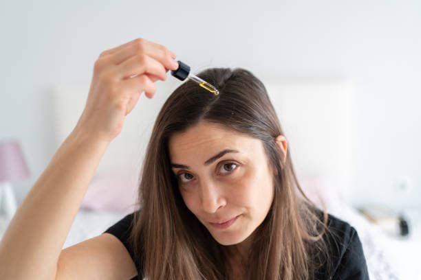 Hair Loss