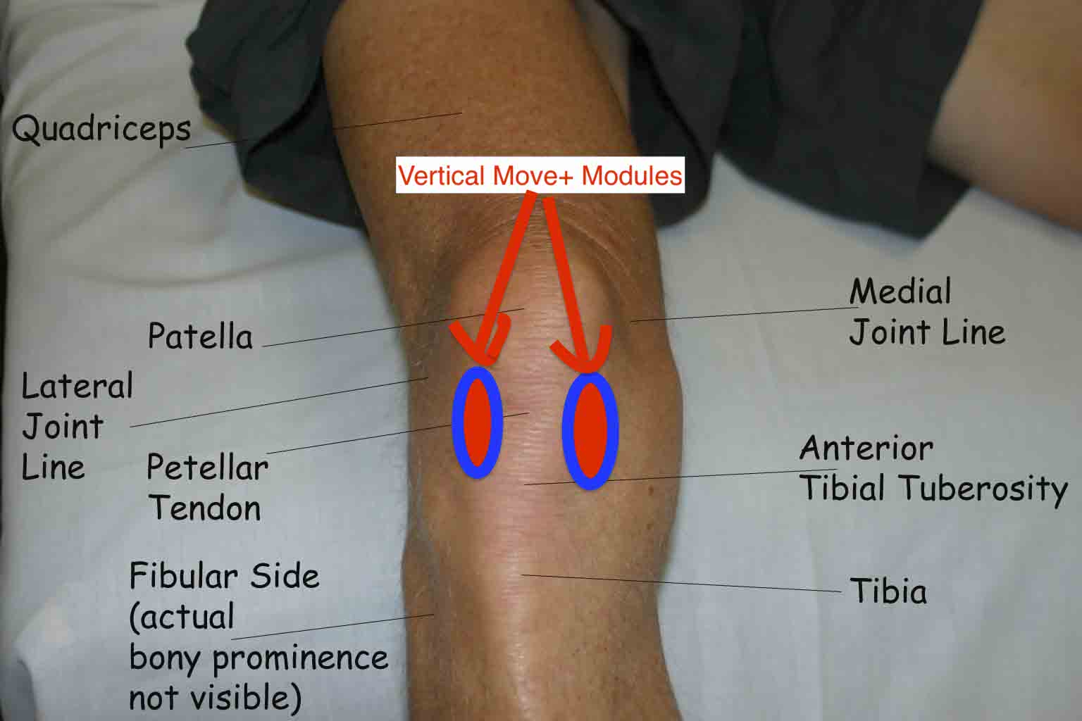 🦵 Knee Treatment Protocol