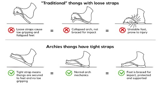 4 reasons why Archies are a great alternative to regular flat thongs