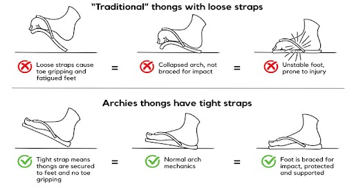 Why do Archies Thongs have a tighter strap and is it good for you?